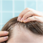 Solutions for a Thinning Hairline in Women That Actually Work