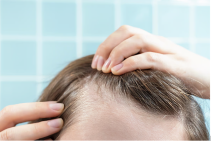 Solutions for a Thinning Hairline in Women That Actually Work